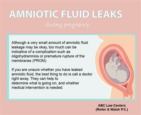 does leaking amniotic fluid smell|Amniotic Fluid: What is It and Signs of Leaking